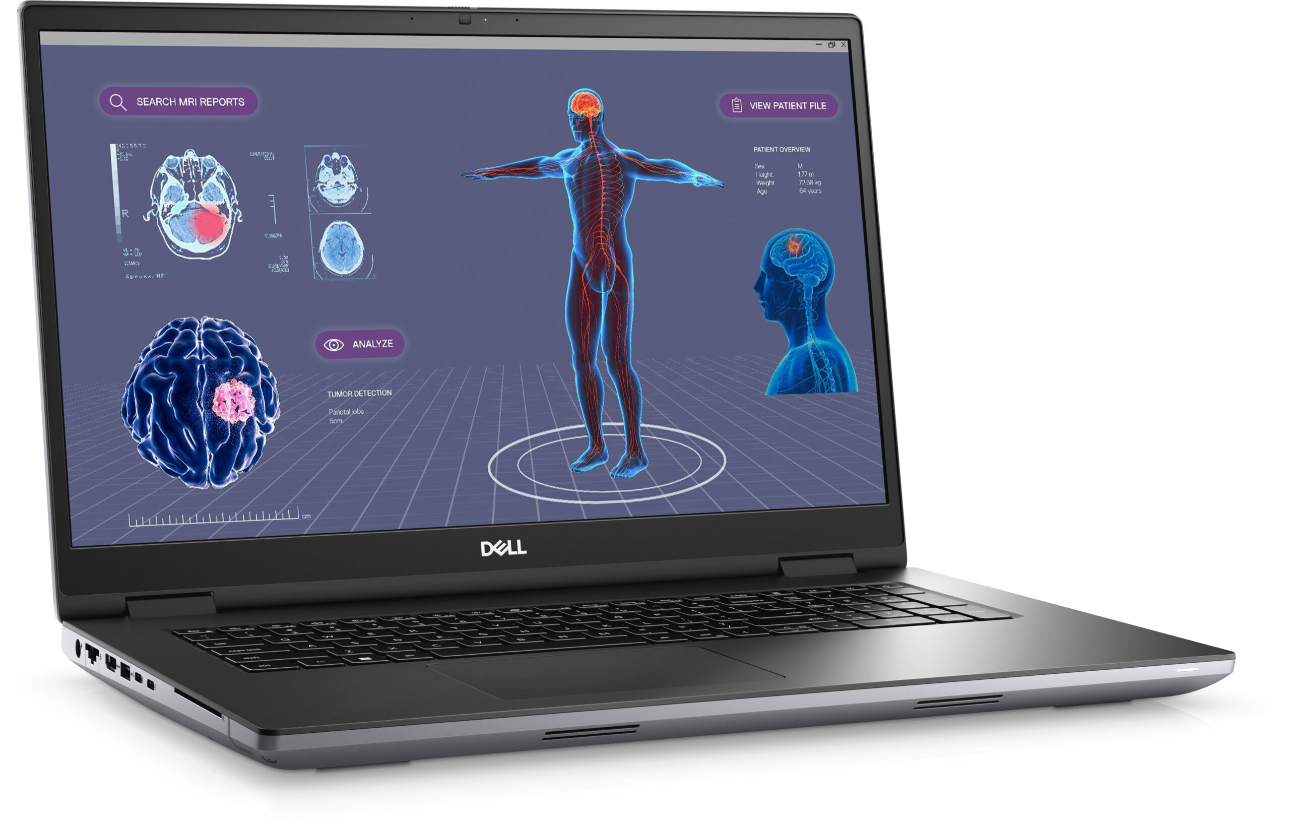Dell Precision 7780 - Billede 2