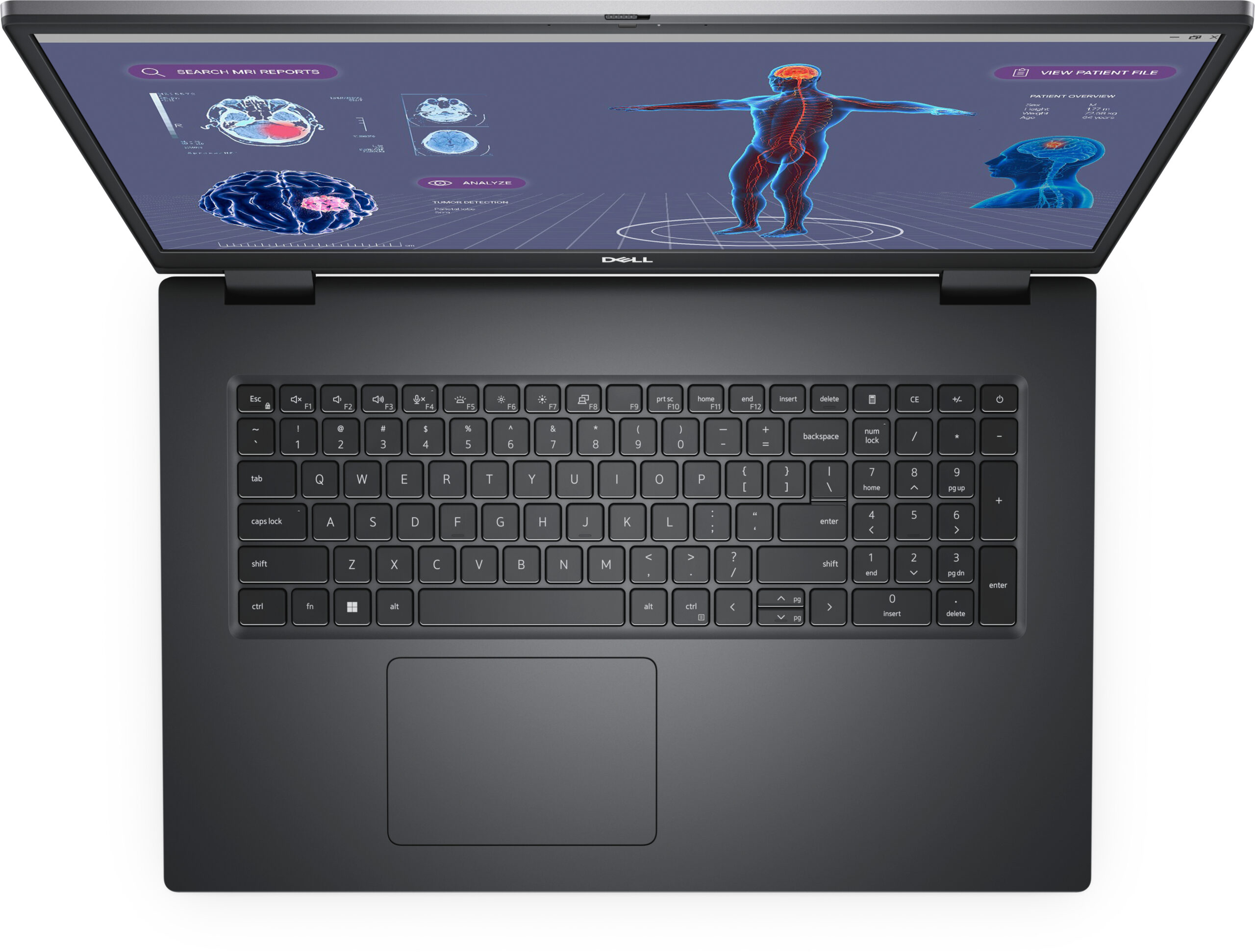 Dell Precision 7780 - Billede 4